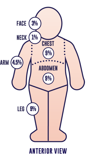  Figure illustrating how body surface area is quantified across body parts via the Palmar Method.