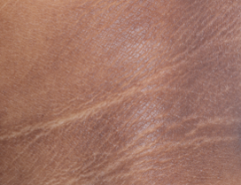 A close-up photo of a patient's neck showing atopic dermatitis after 8 weeks of treatment with OPZELURA and a resulting IGA score of 1