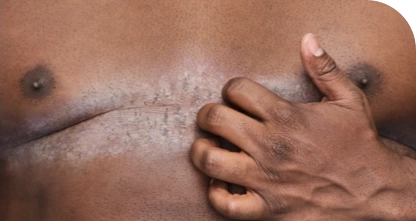  Patient scratching his chest