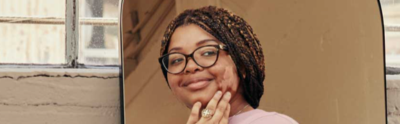 A person showing symptoms of nonsegmental vitiligo